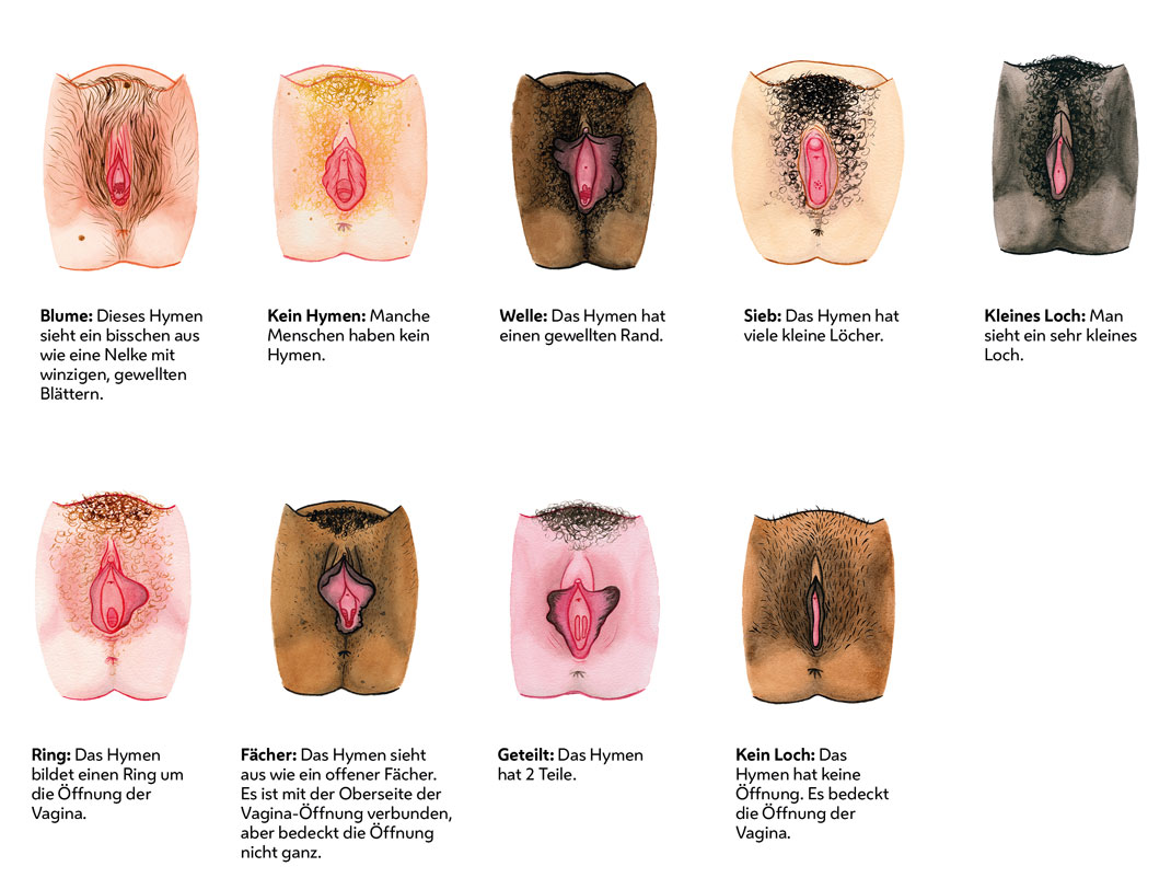 Die Illustration zeigt verschieden geformte Hymen mit Beschreibungen zu Aussehen und Struktur. Das Hymen kann aussehen wie eine Blume, ein Ring, eine Welle, ein Sieb, ein kleines Loch, ein Fächer, es kann geteilt sein. Manche Menschen haben kein Hymen. Oder das Hymen hat keine Öffnung. Farbige Darstellungen betonen Unterschiede in Form, Öffnung und Rand, um Vielfalt und individuelle Merkmale des Hymens zu verdeutlichen.